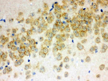 Otoferlin Rabbit Polyclonal Antibody