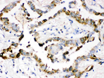 Surfactant protein D/SFTPD Rabbit Polyclonal Antibody
