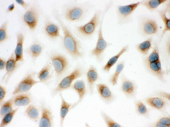 Surfactant protein D/SFTPD Rabbit Polyclonal Antibody
