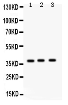 Surfactant protein D/SFTPD Rabbit Polyclonal Antibody