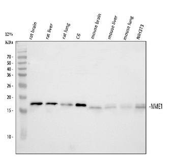 NM23A/NME1 Rabbit Polyclonal Antibody