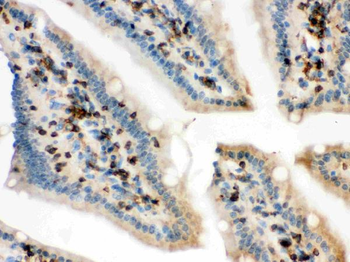 Cofilin/CFL1 Rabbit Polyclonal Antibody