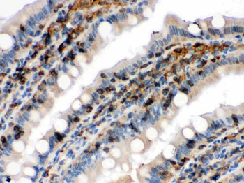 Cofilin/CFL1 Rabbit Polyclonal Antibody
