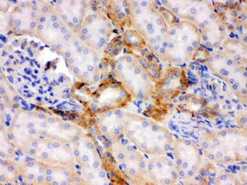Flotillin 2/FLOT2 Rabbit Polyclonal Antibody