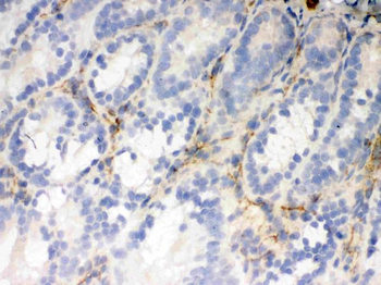 Flotillin 2/FLOT2 Rabbit Polyclonal Antibody