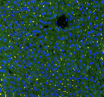 GSTA1/GSTA2/GSTA3/GSTA4/GSTA5 Rabbit Polyclonal Antibody