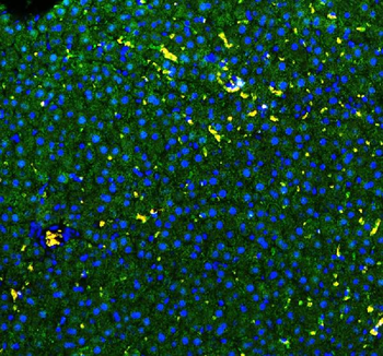 GSTA1/GSTA2/GSTA3/GSTA4/GSTA5 Rabbit Polyclonal Antibody