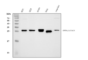 GSTA1/GSTA2/GSTA3/GSTA4/GSTA5 Rabbit Polyclonal Antibody