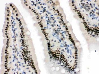 HMG4/HMGB3 Rabbit Polyclonal Antibody