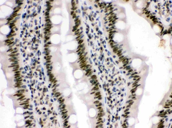 HMG4/HMGB3 Rabbit Polyclonal Antibody