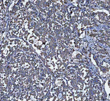 GRP78 BiP/HSPA5 Antibody