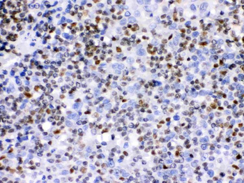 Ikaros/IKZF1 Rabbit Polyclonal Antibody