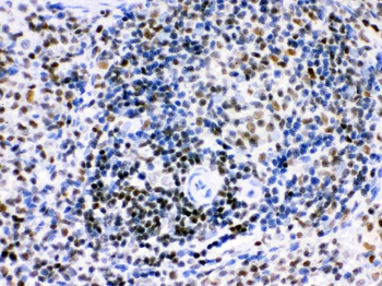 Ikaros/IKZF1 Rabbit Polyclonal Antibody