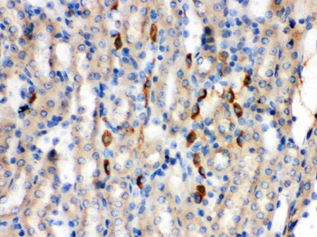 Kininogen 1/KNG1 Rabbit Polyclonal Antibody
