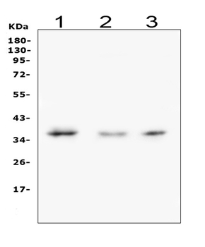 Galectin 8/LGALS8 Rabbit Polyclonal Antibody