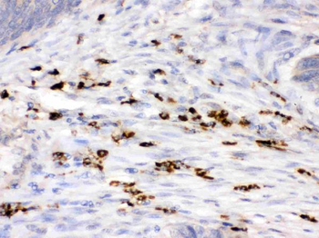 Lysozyme/LYZ Rabbit Polyclonal Antibody