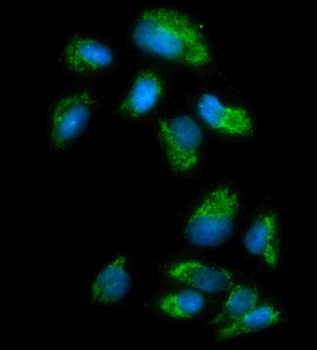 Monoamine Oxidase A/MAOA Antibody