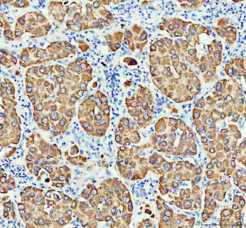 Monoamine Oxidase B/MAOB Rabbit Polyclonal Antibody