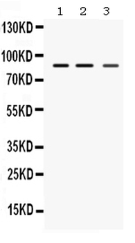 MEFV Rabbit Polyclonal Antibody