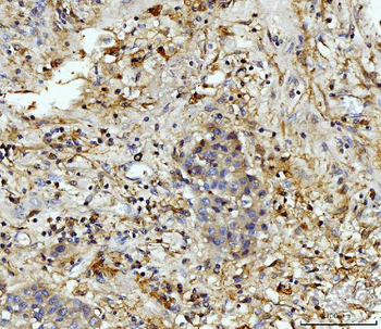 MMP9 Rabbit Polyclonal Antibody