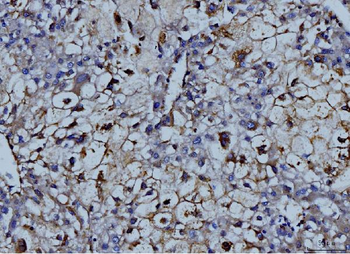 MMP9 Rabbit Polyclonal Antibody