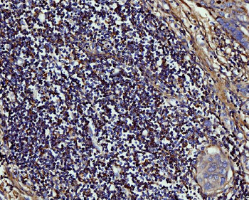 MMP9 Rabbit Polyclonal Antibody