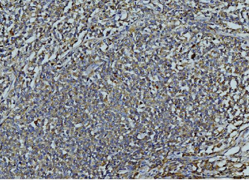 MMP9 Rabbit Polyclonal Antibody
