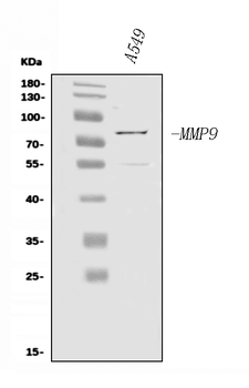 MMP9 Rabbit Polyclonal Antibody