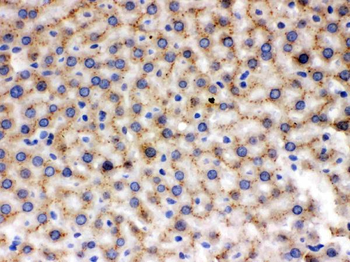 MMP9 Rabbit Polyclonal Antibody