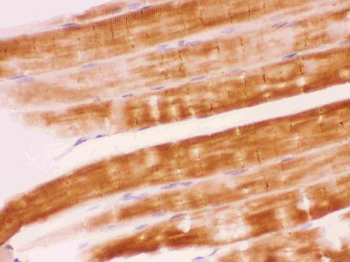 SHP2/PTPN11 Antibody
