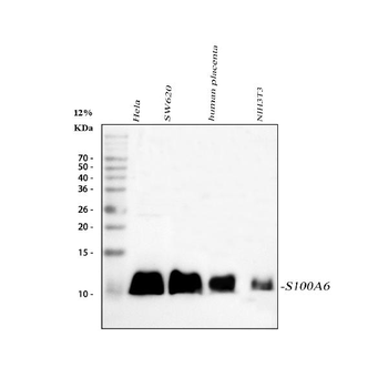S100 alpha 6/S100A6 Antibody
