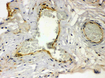 Thrombin Receptor/F2R Rabbit Polyclonal Antibody