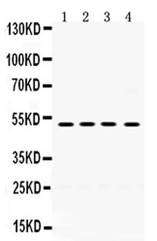 TIM 1/HAVCR1 Antibody