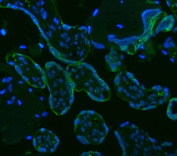 HSD11B2 Rabbit Polyclonal Antibody