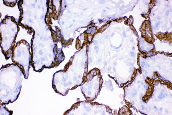 HSD11B2 Rabbit Polyclonal Antibody