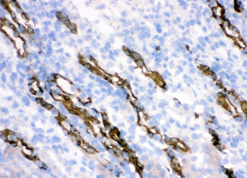 HSD11B2 Rabbit Polyclonal Antibody
