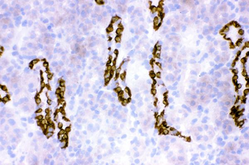 HSD11B2 Rabbit Polyclonal Antibody