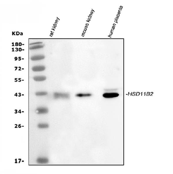 HSD11B2 Rabbit Polyclonal Antibody