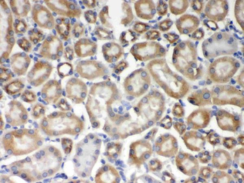 AIM2 Rabbit Polyclonal Antibody