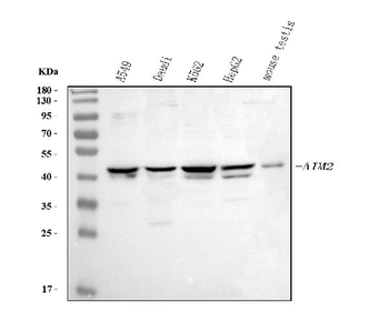 AIM2 Rabbit Polyclonal Antibody
