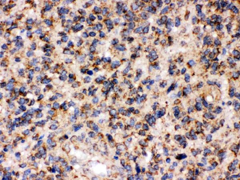 FE65/APBB1 Rabbit Polyclonal Antibody