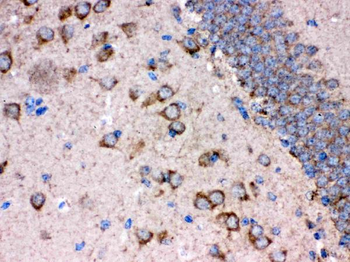 FE65/APBB1 Rabbit Polyclonal Antibody