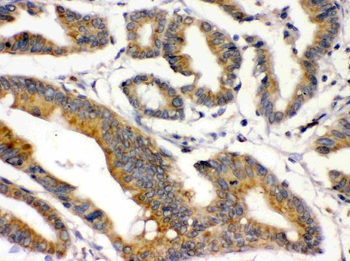 BMP2 Rabbit Polyclonal Antibody
