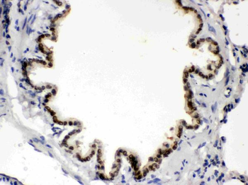 BMP5 Rabbit Polyclonal Antibody