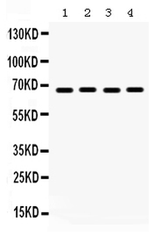 Pea3/ETV4 Rabbit Polyclonal Antibody