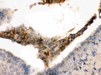 GNAQ Rabbit Polyclonal Antibody