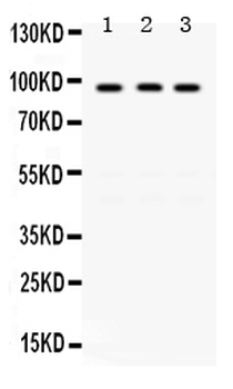 KAT2A/GCN5 Rabbit Polyclonal Antibody