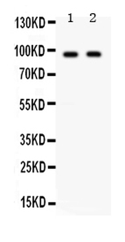 p90 Autoantigen/KIAA1524 CIP2A Rabbit Polyclonal Antibody