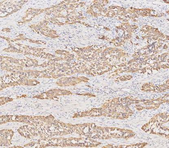 Cytokeratin 19/KRT19 Antibody