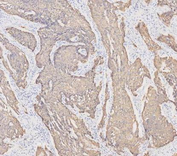 Cytokeratin 19/KRT19 Antibody